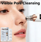 Blackhead Remover Pore Vacuum, Facial Pore Cleaner - 5 Suction Power, 5 Probes, USB Rechargeable