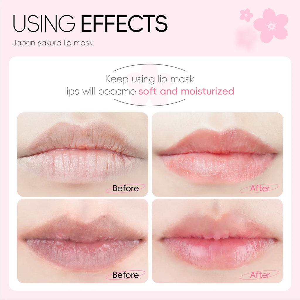 LAIKOU 5/10pcs Lip Mask Lip Care Moisturizing Hydrating Repair Lighten Lip Lines  Gel Patch Lips Pad Patches Care Products